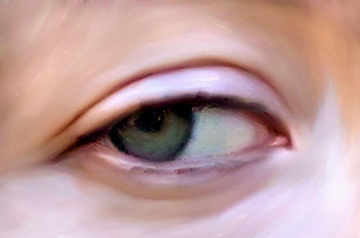 Eye I